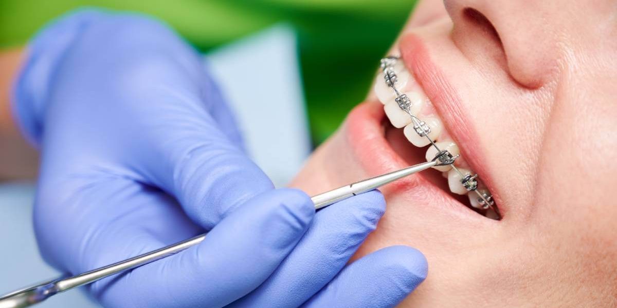 5-Surprising-Benefits-of-Straight-Teeth-Beyond-Aesthetics