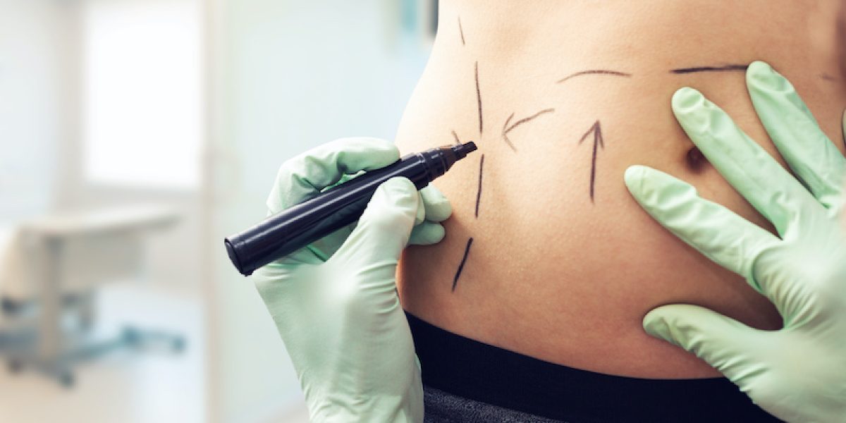 Ab-repair-surgery