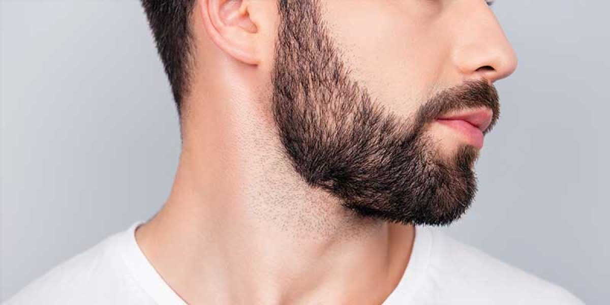 Beard-Hair-Transplants-for-Thinning-Beards-What-You-Need-to-Know