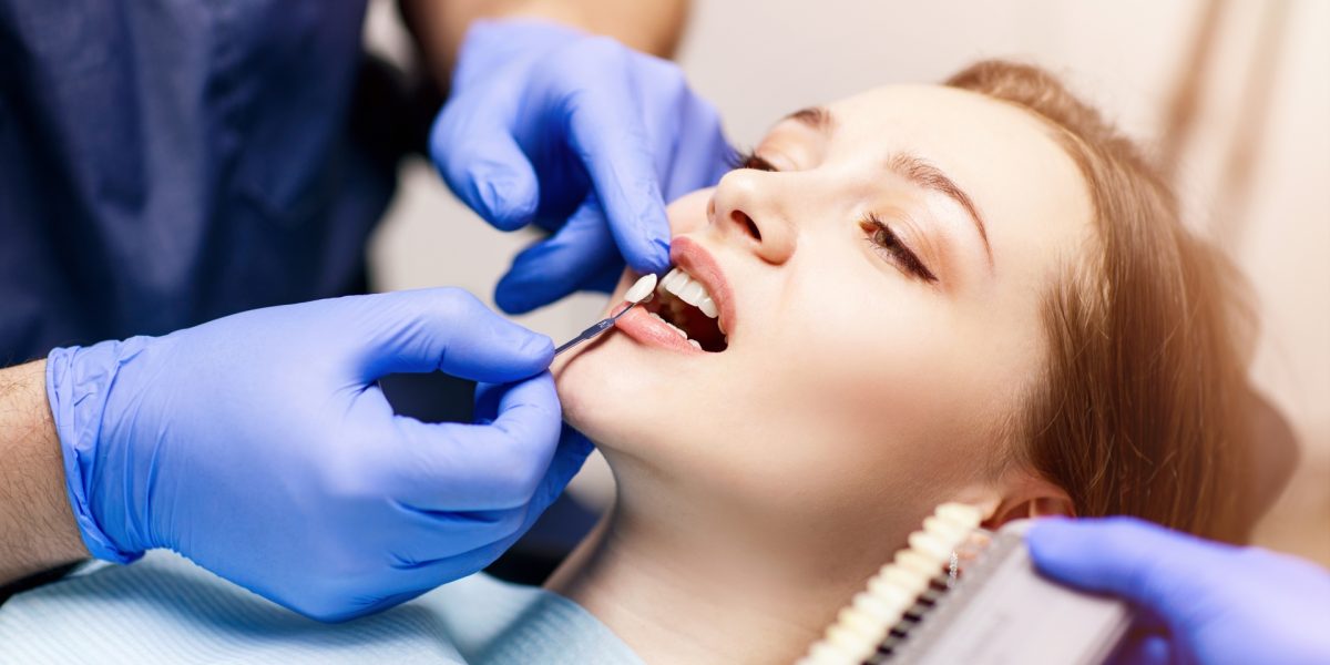 Before-and-After-What-to-Expect-from-Teeth-Whitening