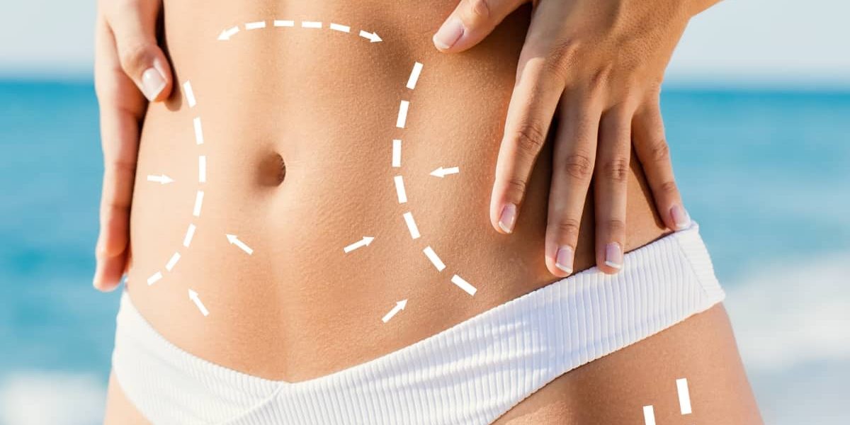 Body-Sculpting-Treatment-for-a-Toned-Figure