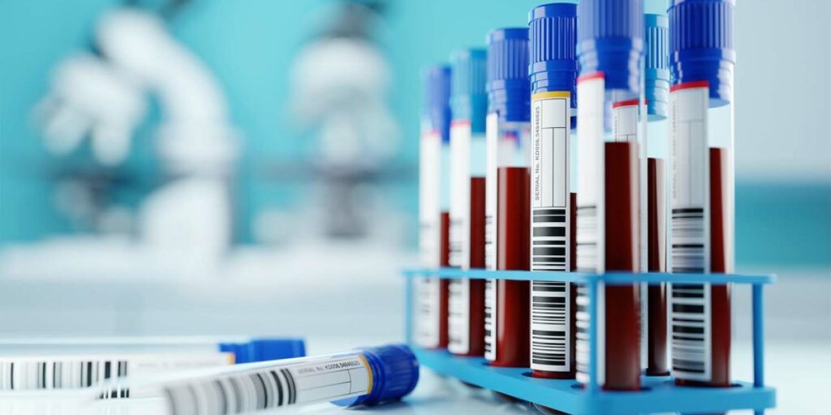 Boost-Energy-with-Blood-Tests-for-Body-Analysis