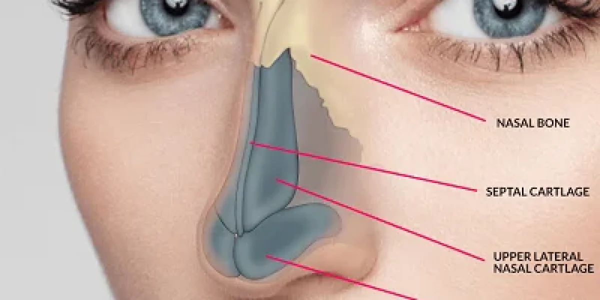 Breathing-Problem-Nose-Surgery-Islamabad