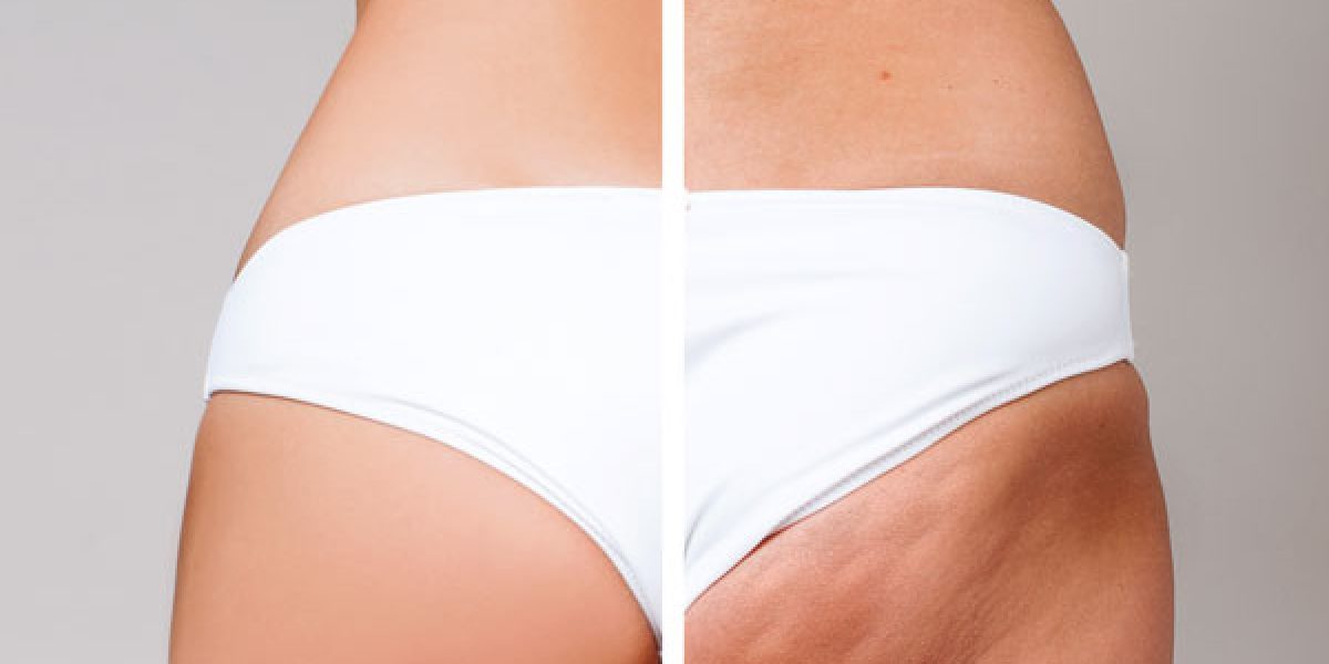 Confidence-in-every-curve