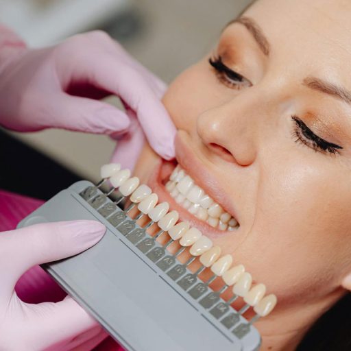 Dental-Veneers-Treatment-in-Highett-VIC-