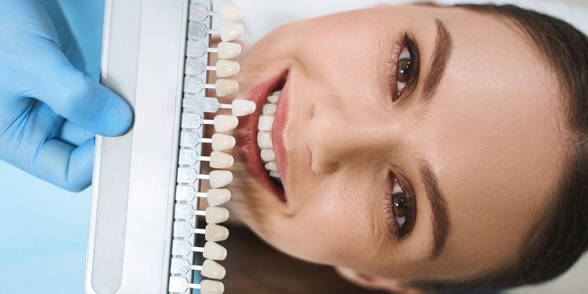 Do-Composite-Veneers-Hurt-What-the-Procedure-Feels-Like
