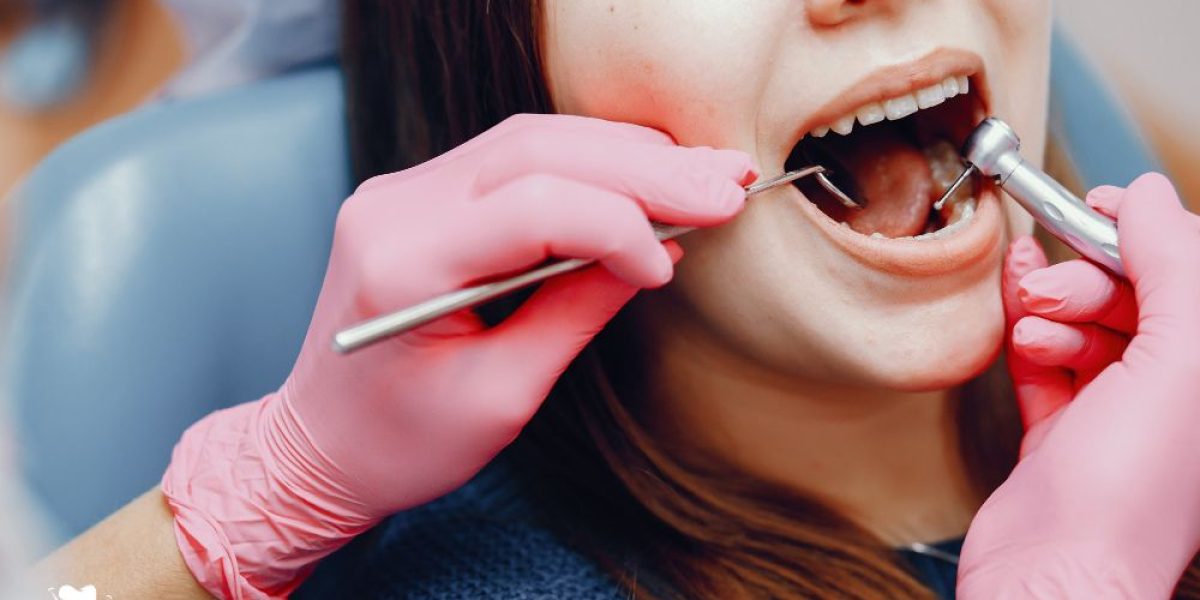 Does-Teeth-Polishing-Whiten-Your-Teeth-Busting-the-Myths
