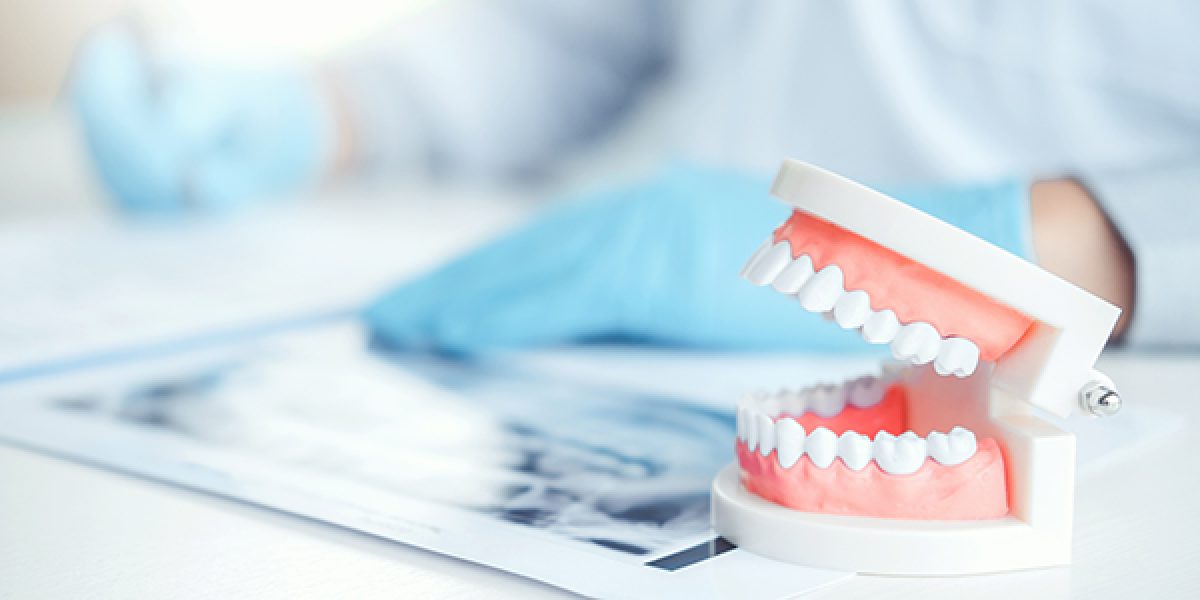 Everything-You-Need-to-Know-About-Dental-Veneers