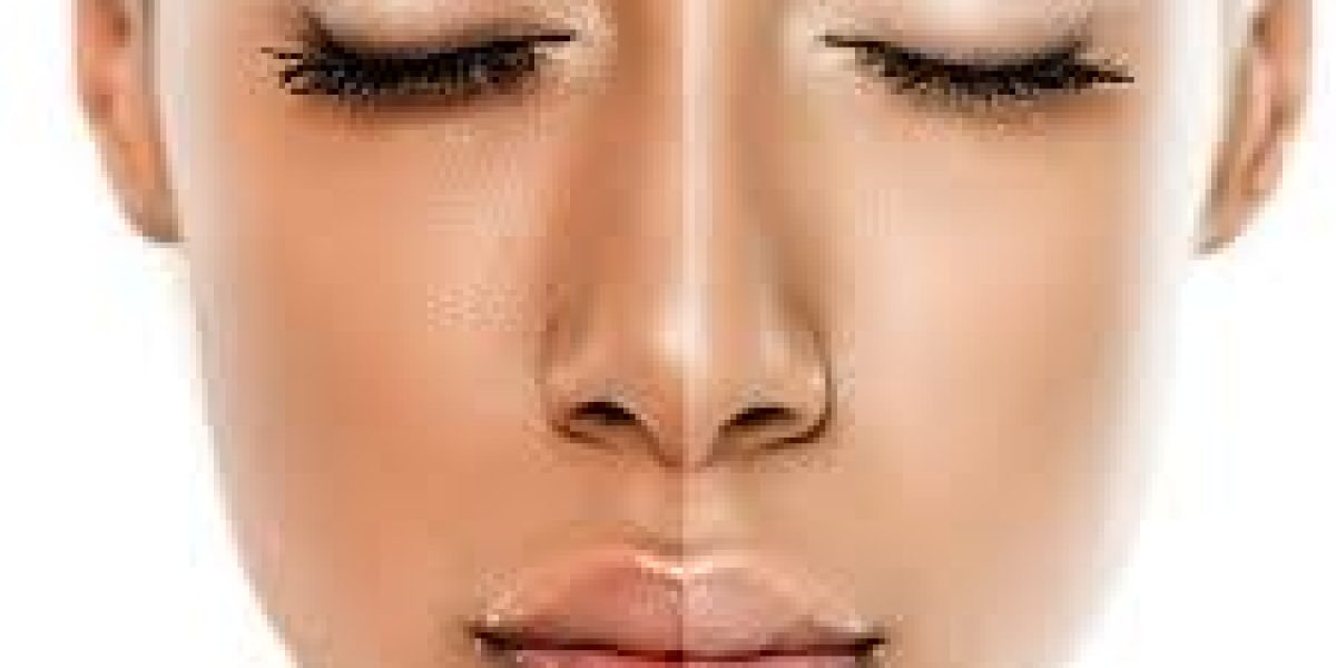Face-Skin-Whitening-Cream