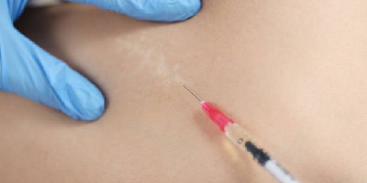 Fat-melting-injection-in-Dubai13