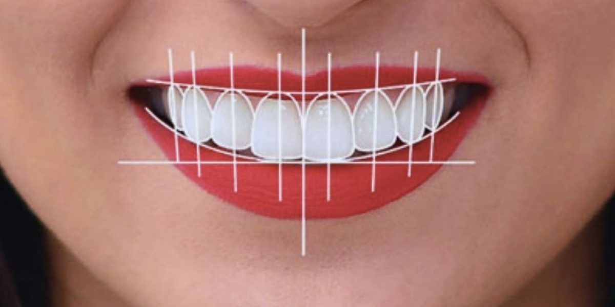 From-Scan-to-Smile-The-Digital-Smile-Design-Workflow
