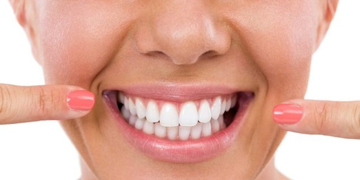 Full-Mouth-Rehabilitation-What-It-Is-and-Who-Needs-It