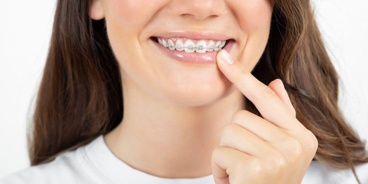 How-Dental-Braces-Affect-Your-Oral-Hygiene-Routine