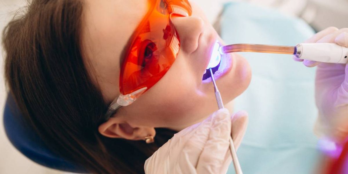 How-Long-Does-Zoom-Teeth-Whitening-Last