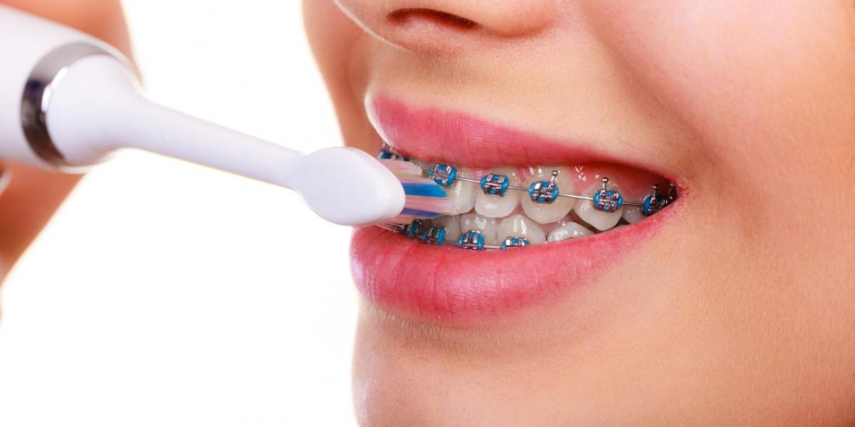 How-to-Choose-the-Right-Orthodontist-for-Your-Family