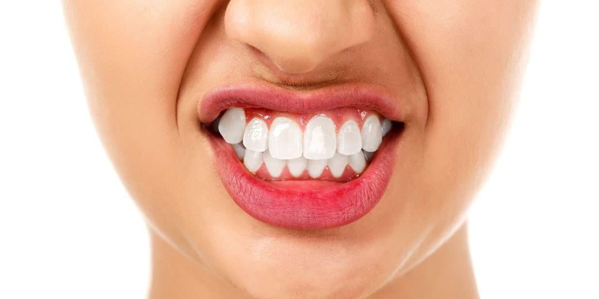 Is-Composite-Bonding-Safe-A-Look-at-the-Risks-and-Benefits