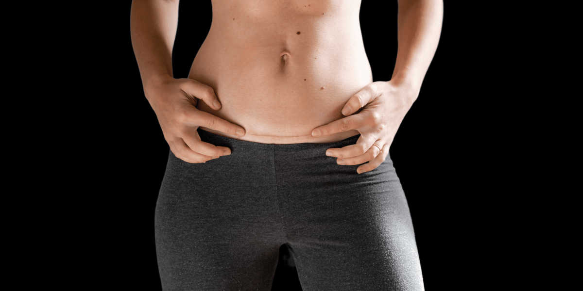 Laser-Liposuction-vs.-Traditional-Liposuction