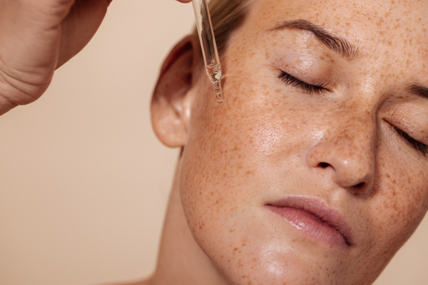 Laser-treatments-target-melasma-pigmentation