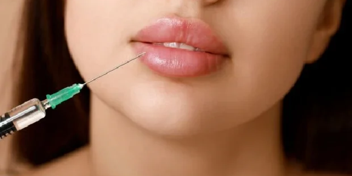 Lip-Botox-Minimal-Downtime-Maximum-Impact