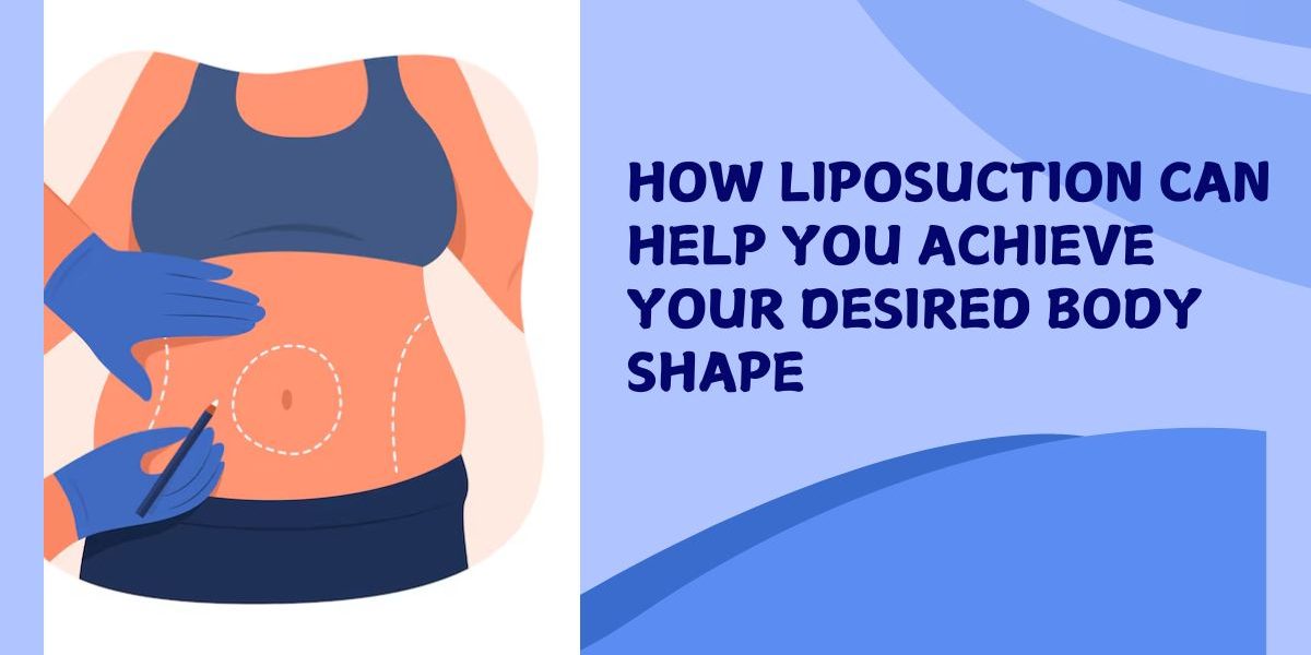 Liposuction