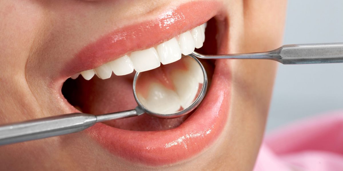 Mercury-in-Fillings-Is-Amalgam-Still-Safe