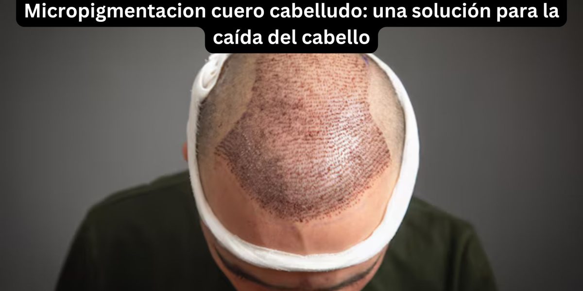 Micropigmentacion-cuero-cabelludo-una-solucion-para-la-caida-del-cabello