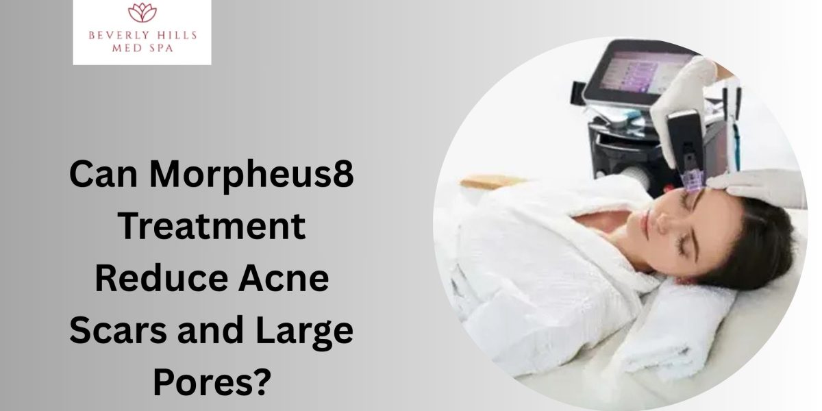 Morpheus-Face-Treatment-1