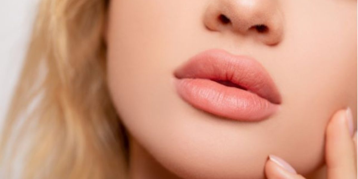 Non-surgical-lip-volume