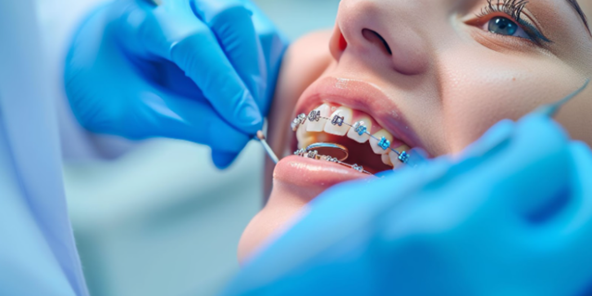 Orthodontic-Retainers-Why-They-Matter-More-Than-You-Think