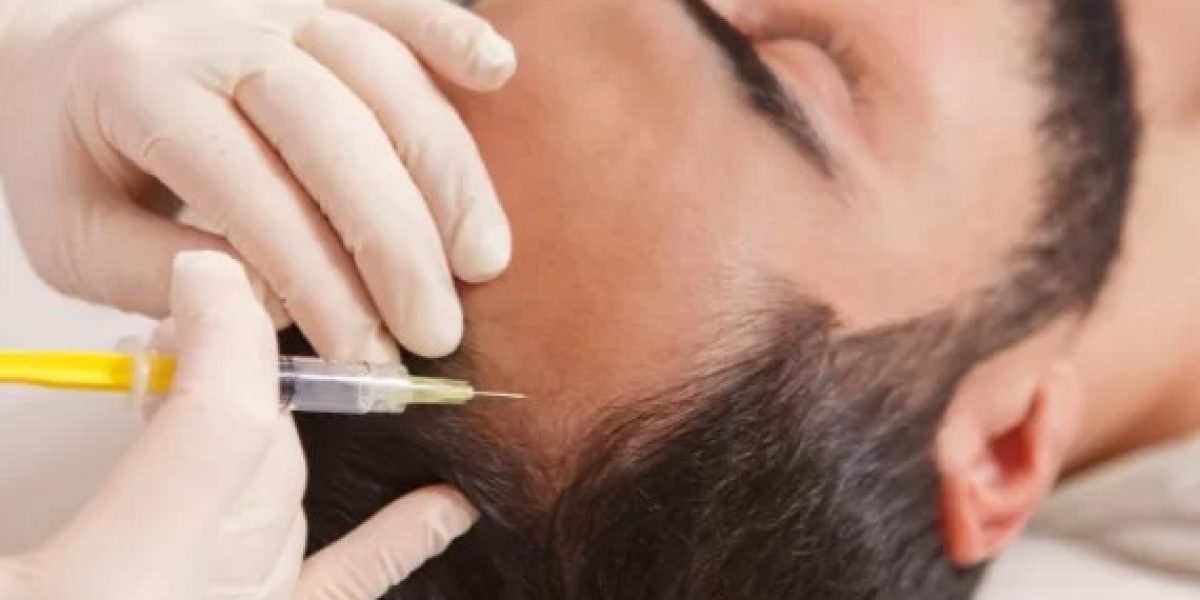 PRP-tightens-skin