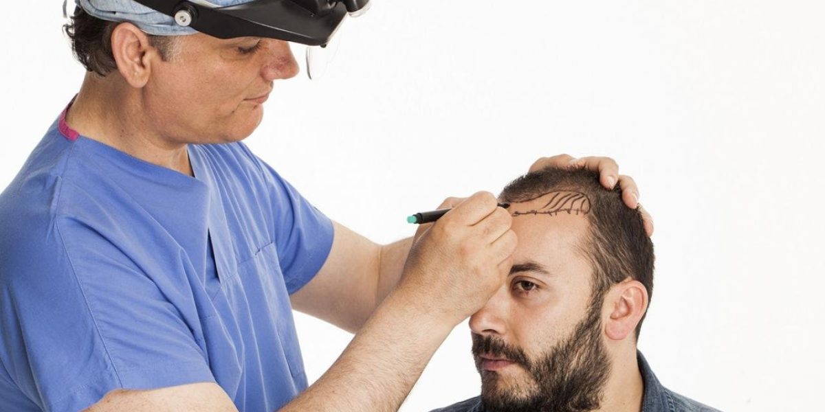 Permenent-Hair-Transplant-in-Islamabad