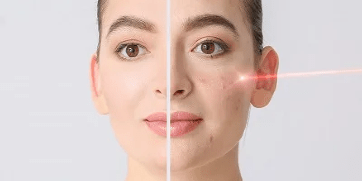 Restore-skin-beauty