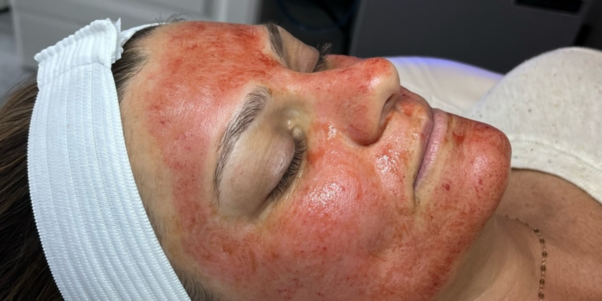 Say-yes-to-firm-skin