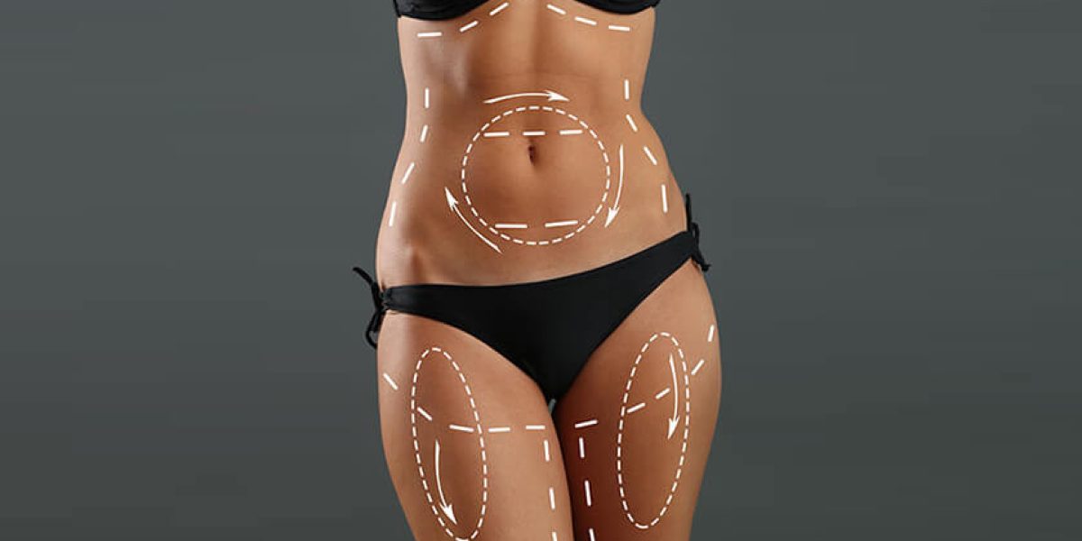 Sculpt-your-body-with-liposuction