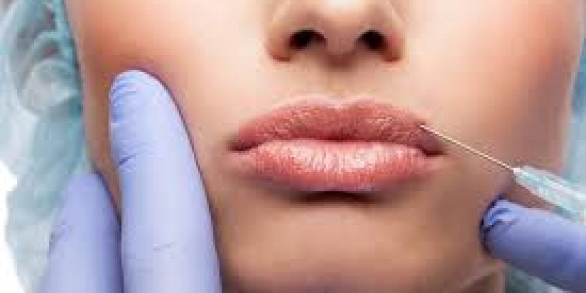 Subtle-lip-plumping