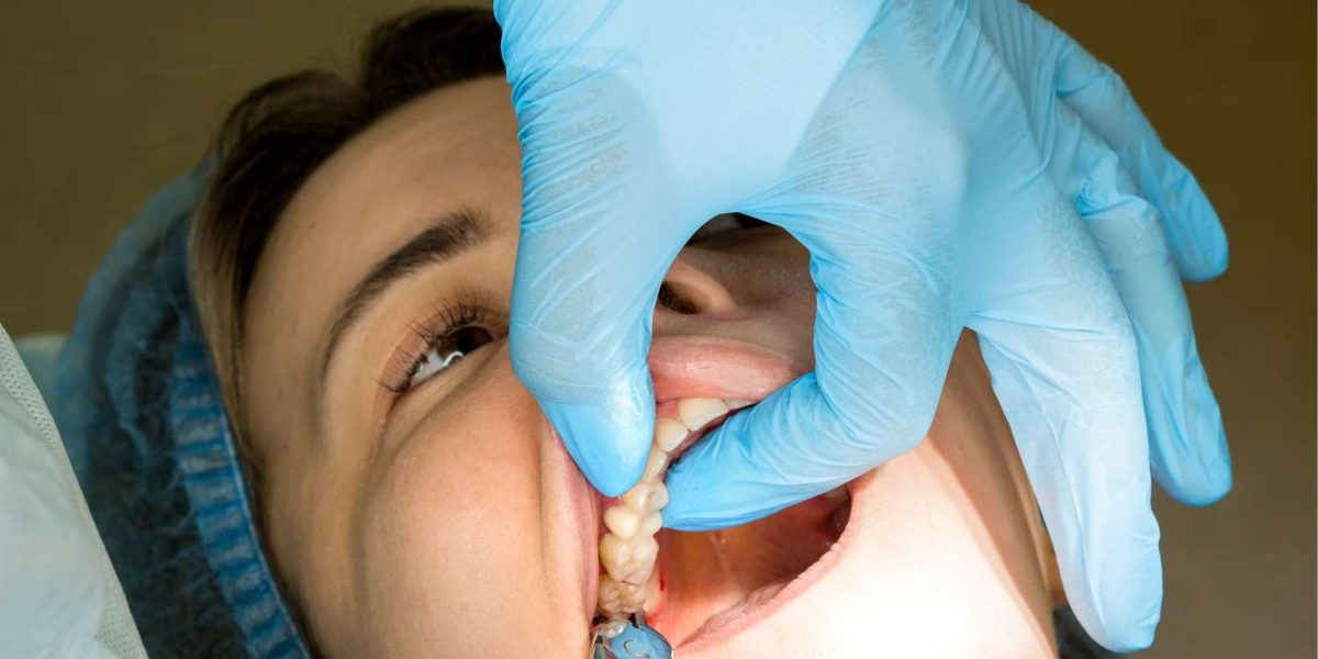 The-Complete-Guide-to-Tooth-Removal-What-to-Expect