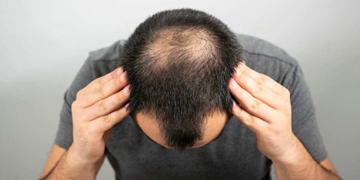 The-Role-of-PRP-Therapy-in-Enhancing-Hair-Transplant-Results