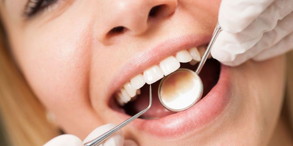 The-Ultimate-Guide-to-Teeth-Cleaning-What-You-Should-Know