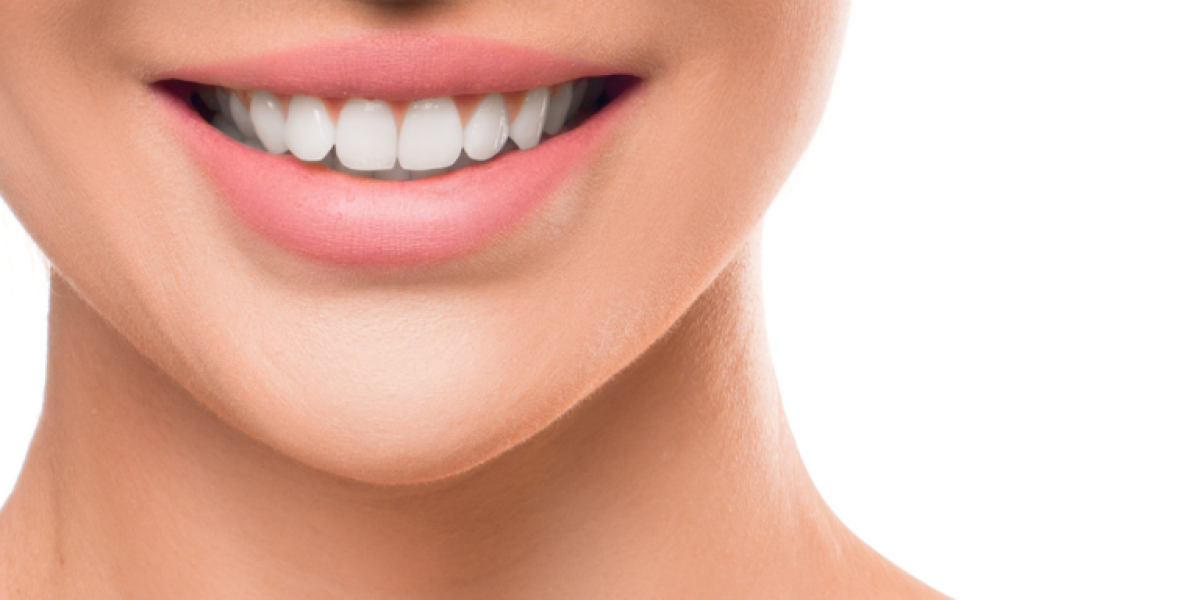Top-5-Questions-Patients-Ask-About-Gum-Depigmentation