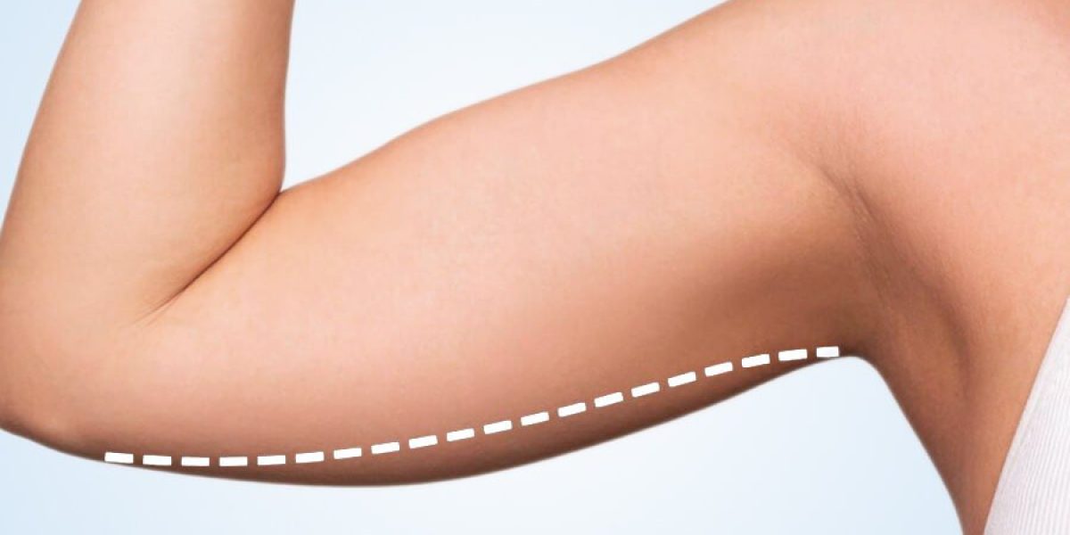 Top-Tips-for-Maintaining-Brachioplasty-Results