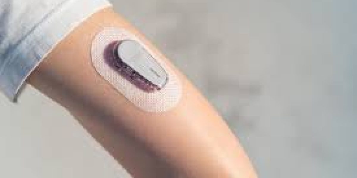 United-Kingdom-Diabetes-Device-Market