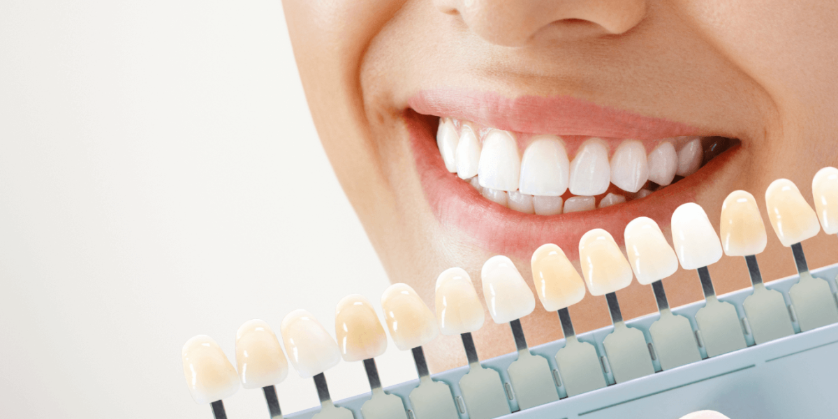 Whitening-Toothpastes-2025s-Best-Picks-Reviewed