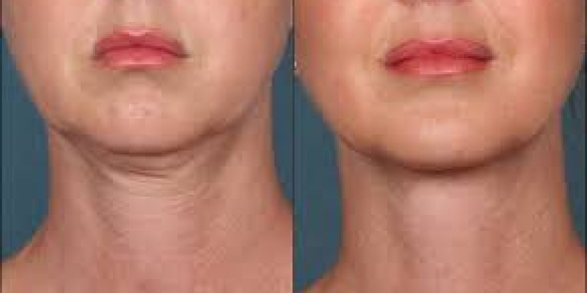 Youthful-skin-starts-here
