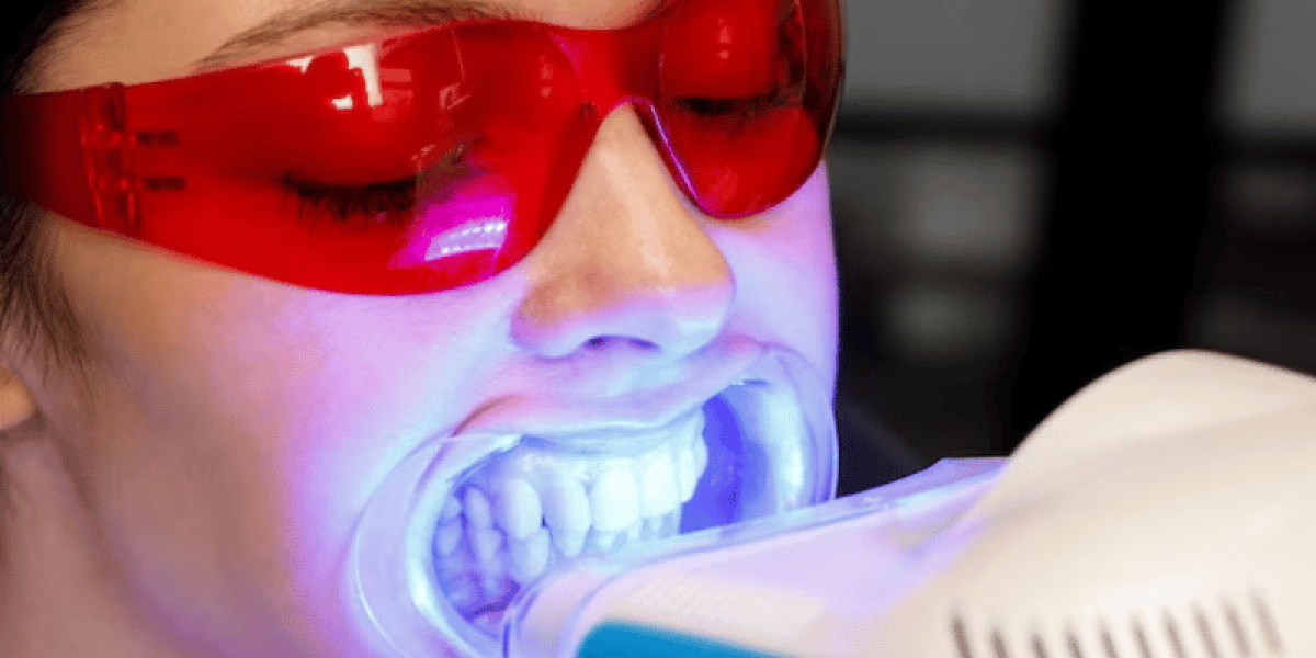 Zoom-Teeth-Whitening-Before-a-Big-Event-Is-It-Worth-It