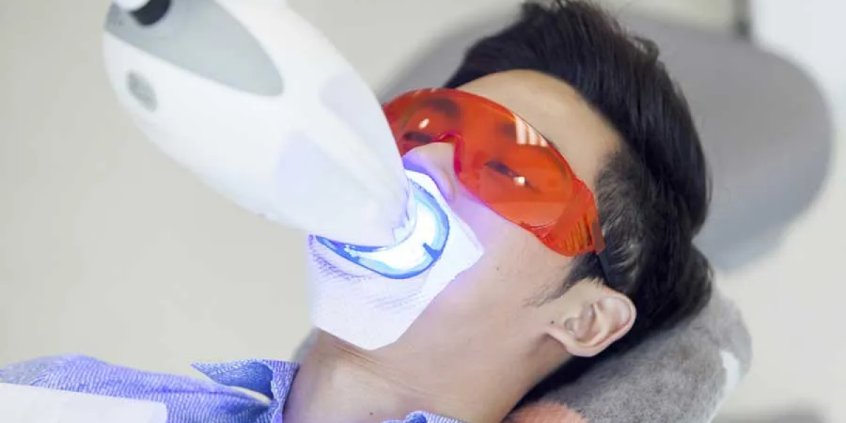 Zoom-Teeth-Whitening-for-Special-Occasions-A-Quick-Fix-for-a-Dazzling-Smile