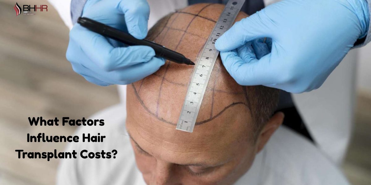hair-transplant-price-1