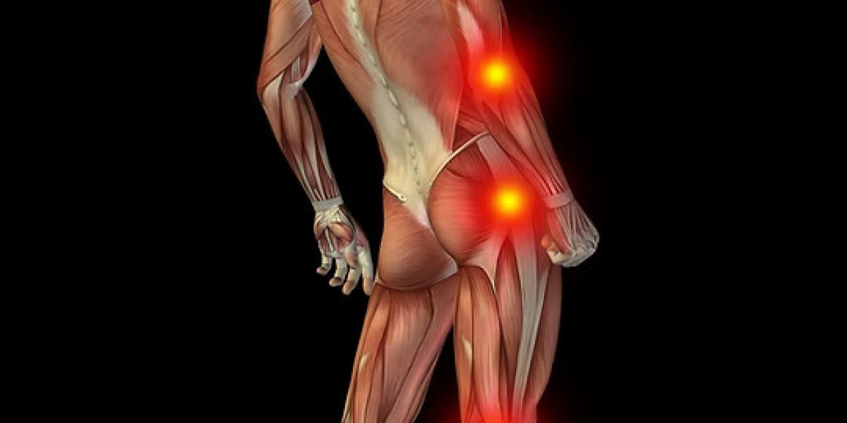 muscle-pain-arm-and-leg