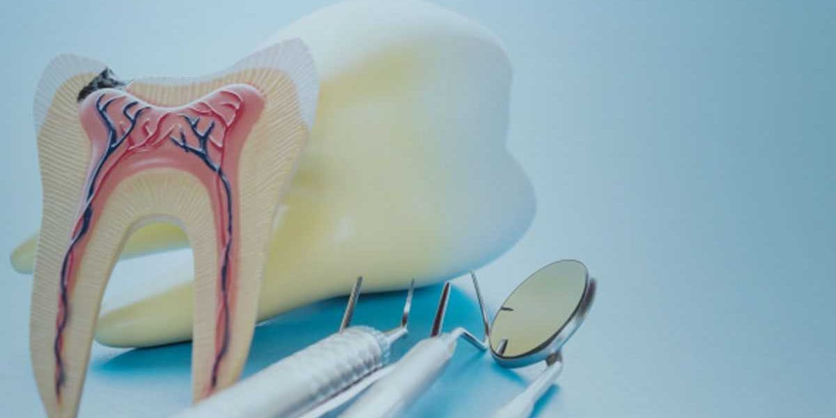 root-canal-treatment