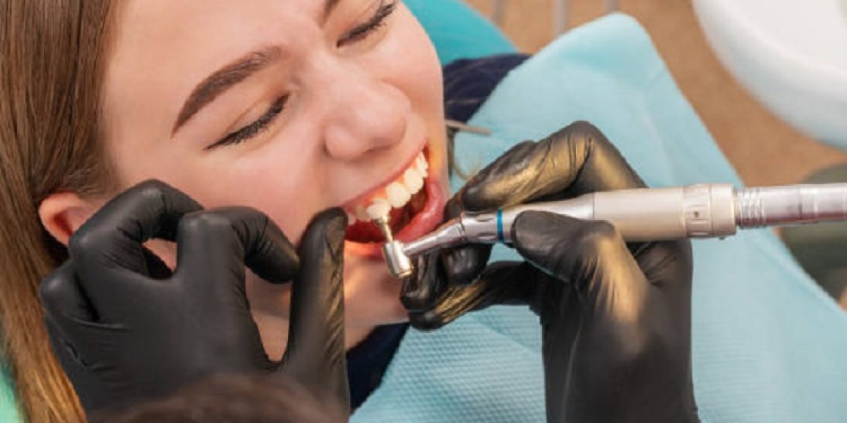 تنظيف-وتلميع-الاسنان-في-الرياض-6